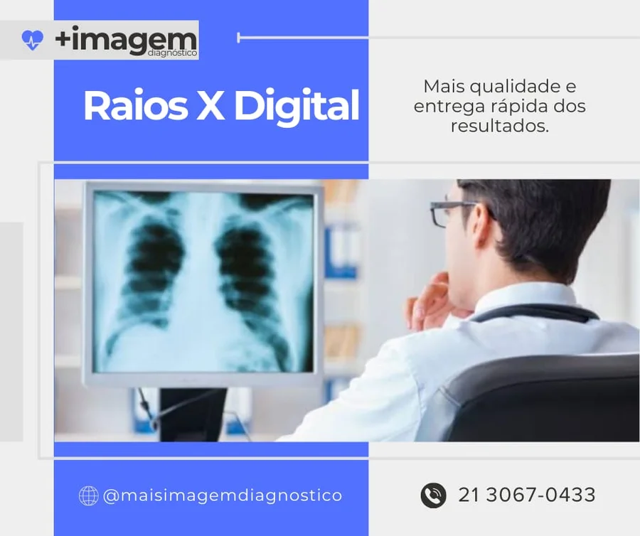 Illustrative image of Raios X